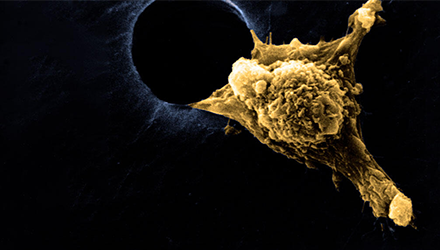 CNRS Le JOURNAL – Le secret des cellules baladeuses